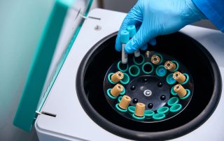 mid-iowa-fertility-Smarter-IVF-Using-Freezing-_-Screening-To-Achieve-The-Best-Outcomes